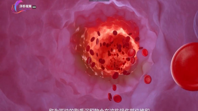 站起来就头晕？可能是低血压在作怪！